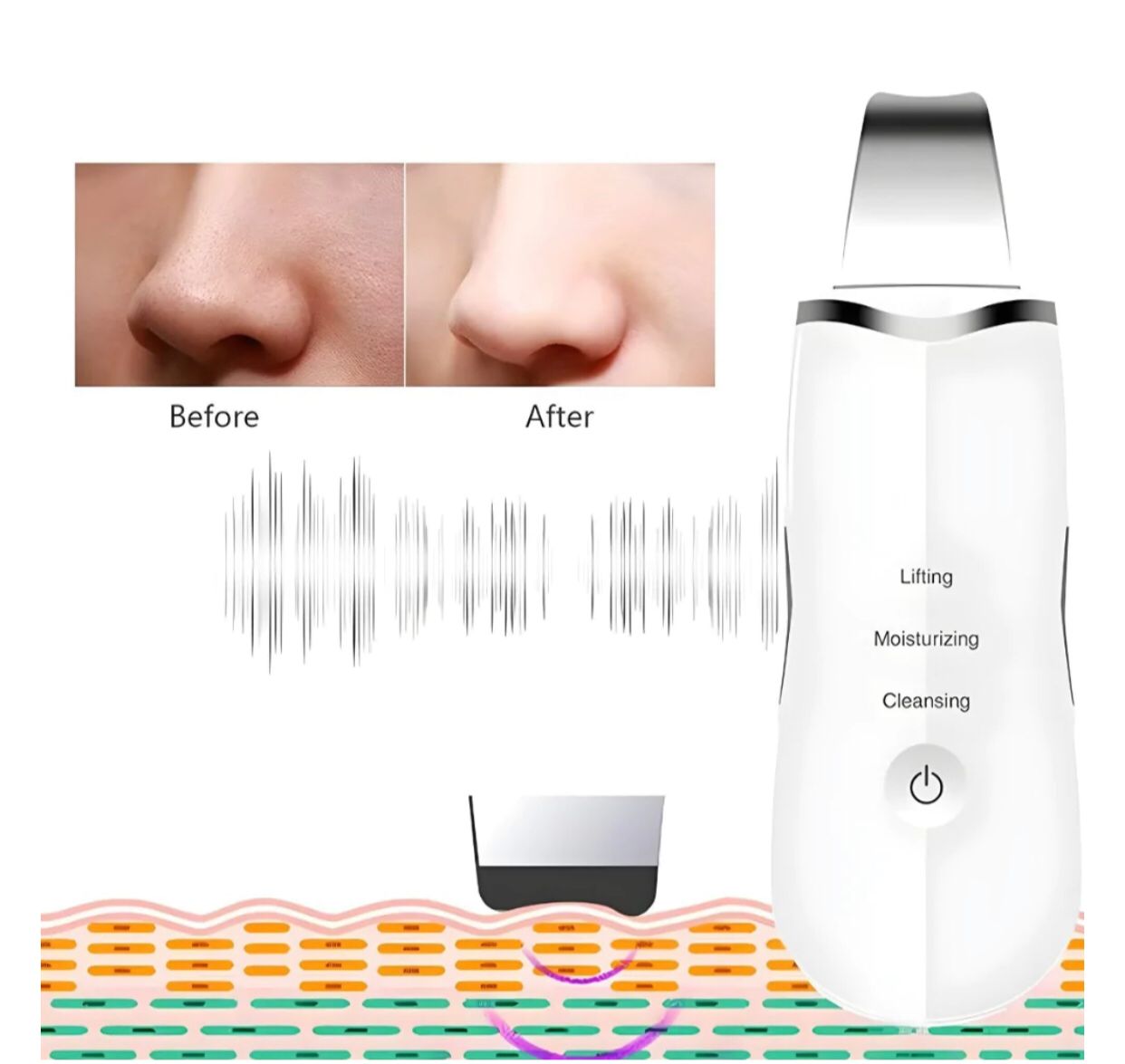 Ultrasonic Facial Cleaner